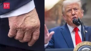 Trump health